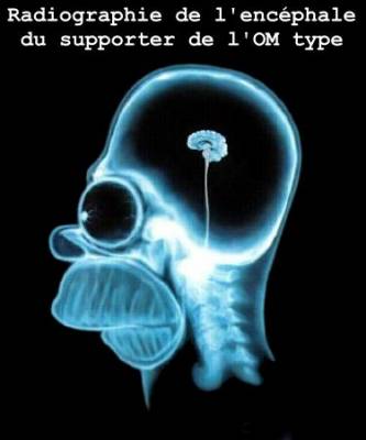 crane du supporter marseillai(il et con!!!!)